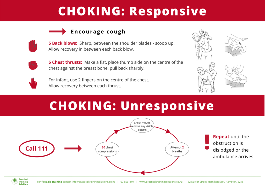 First aid for choking